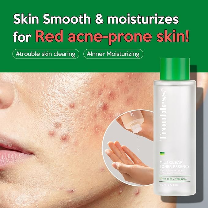 Troubless Mild Clear Toner Essence - Tea Tree Facial Toner for All Skin Types | Hydrating Skin Toner, Daily Skin Care (6.76 fl oz)-VivaGrace Women