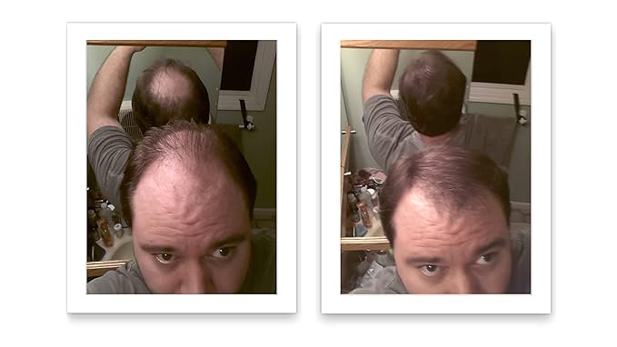 Quick Fix For Thinning Hair and Bald Spot. Get 10X Fuller Hair Instantly. All-Natural Hair Building Fiber For Hair. Trial Size (10-Day Supply). Light Brown-VivaGrace Women