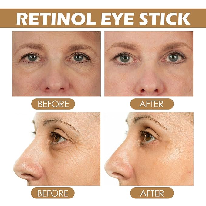 Retinol Eye Stick with Collagen & Hyaluronic Acid Eye Cream for Dark Circle and Puffiness, Brightening Eye Balm Reduces Fine Lines and Bags in 4 Weeks-VivaGrace Women