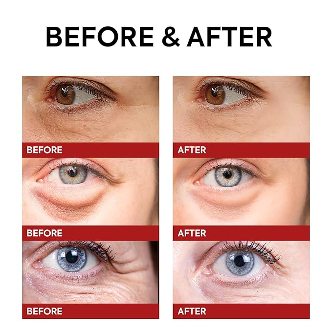 Rapid Reduction Retinol Eye Cream: Under Eye Cream Instantly Reduces Wrinkles Fine Lines Under Eye Bags Puffiness Dark Circles Crow's Feet - Rapid Face Lifting Tightening Firming 1 OZ/15g-VivaGrace Women