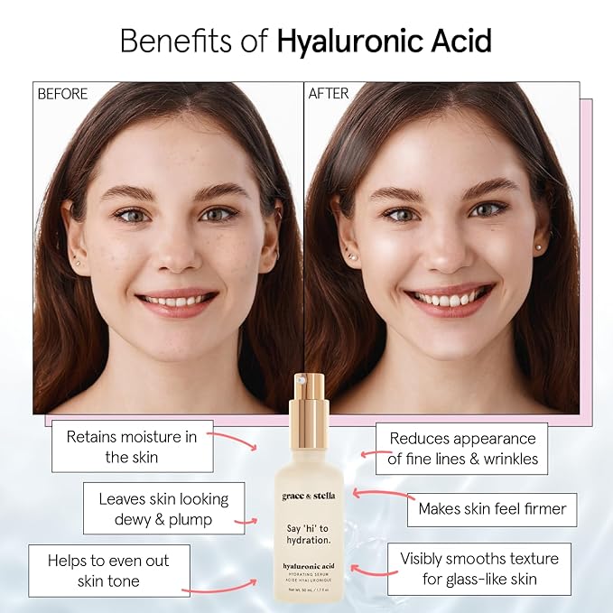 grace & stella Award Winning Hyaluronic Acid Face Serum (50ml/1.7 fl oz) Removes Fine Lines & Wrinkles, Hydrating Hyaluronic Acid Serum for Face, Acido Hialuronico for Women - Vegan Skincare (2-Pack)-VivaGrace Women