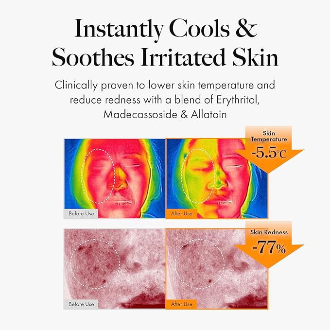 MASTINA Mastic Face Spray (1.69fl oz) Facial Mist for Natural Glow, Hydrating Formula for Dry Skin, On-the-Go Portable Korean Skin Care, Travel Summer Essentials. Mastic Gum.-VivaGrace Women