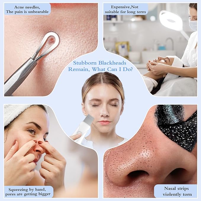 Skin Scrubber Face Spatula Skin Spatula Pore Cleaner Blackhead Remover Tools for Facial Deep Cleansing Skin Care Tool for Men and Women (White)-VivaGrace Women