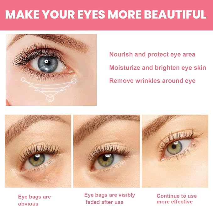 Rosehip Eye Cream Stick, Moisturizing, Hydrating, Lightens Lines and Dark Circles, Lifting, Firming-VivaGrace Women