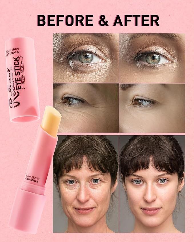 Under Eye Stick For Puffiness: Retinol Under Eye Treatment Reducing Eye Bags and Dark Circles - Eye Balm for Fine Lines, Wrinkles and Puffiness, Eye Cream for Late Nights,-VivaGrace Women