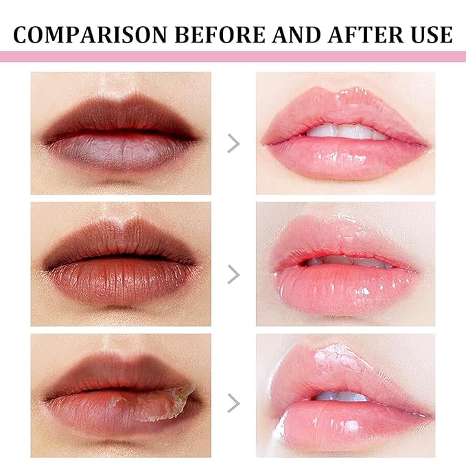 2pcs Lip Lightening for Dark Lips Lip Brightener for Smokers Dark Lip Treatment Lightening Cream for Pink Lips Lip Lightener for Smoker Lips Lip Lightening balm for Men and Women (Red)-VivaGrace Women