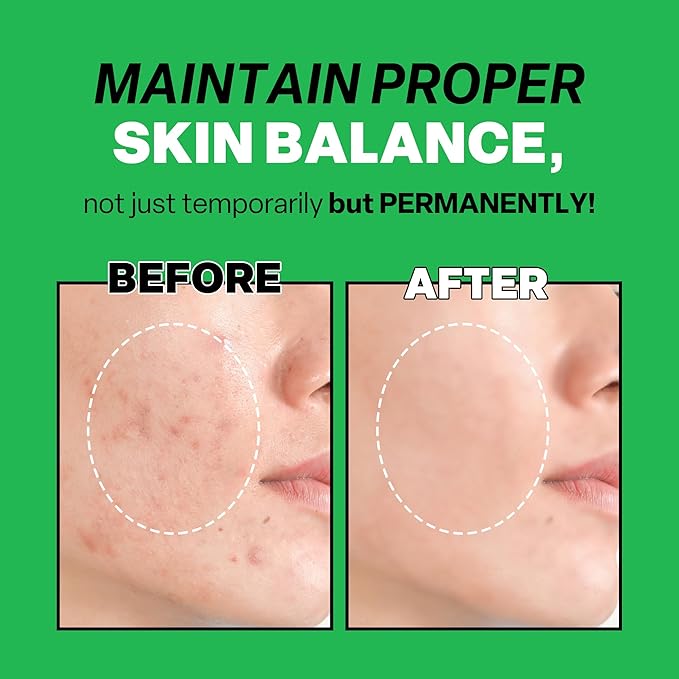 Troubless Mild Clear Toner Essence - Tea Tree Facial Toner for All Skin Types | Hydrating Skin Toner, Daily Skin Care (6.76 fl oz)-VivaGrace Women