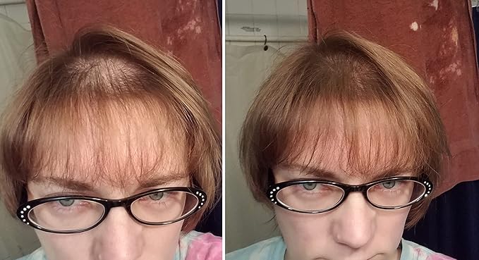 Quick Fix For Thinning Hair and Bald Spot. Get 10X Fuller Hair Instantly. All-Natural Hair Building Fiber For Hair. Trial Size (10-Day Supply). Light Brown-VivaGrace Women