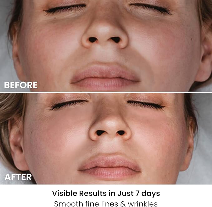 AMIRO Spectra 5-in-1 Light Therapy Face Mask, Contour With Blue, Red, Green, Yellow, and Infrared Light, 3 Modes for Oily, Acne-Prone, and Sagging Skin, Skincare for Face, Silver-VivaGrace Women