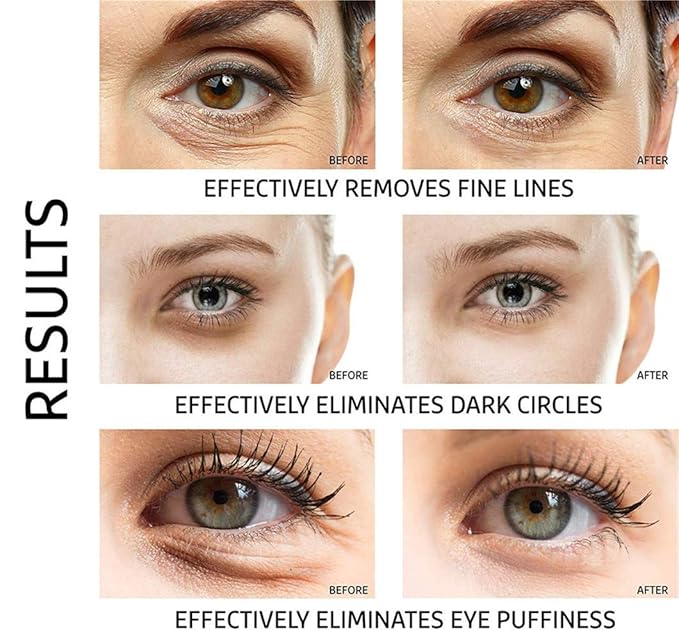 Under Eye Patches - 30 Pairs Collagen Eye Mask Eye Patches for Puffy Eyes and Dark Circles, Gel Under Eye Mask, Black-VivaGrace Women