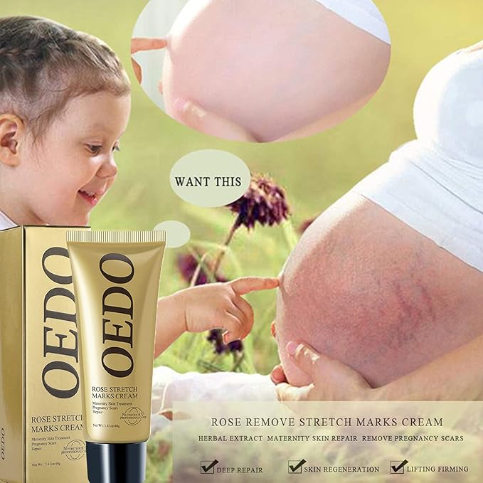 Rose Remove Stretch Marks Cream for Pregnancy Scar Removal Cream Natural Plant Essence Formula Prevention Remove Stretch Mark Old Scars Body Moisturizer 40g-VivaGrace Women