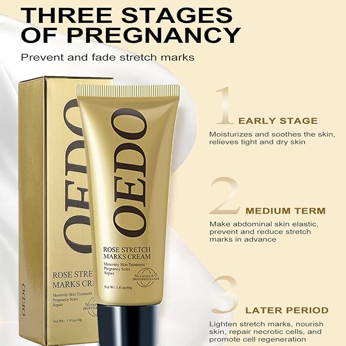 Rose Remove Stretch Marks Cream for Pregnancy Scar Removal Cream Natural Plant Essence Formula Prevention Remove Stretch Mark Old Scars Body Moisturizer 40g-VivaGrace Women