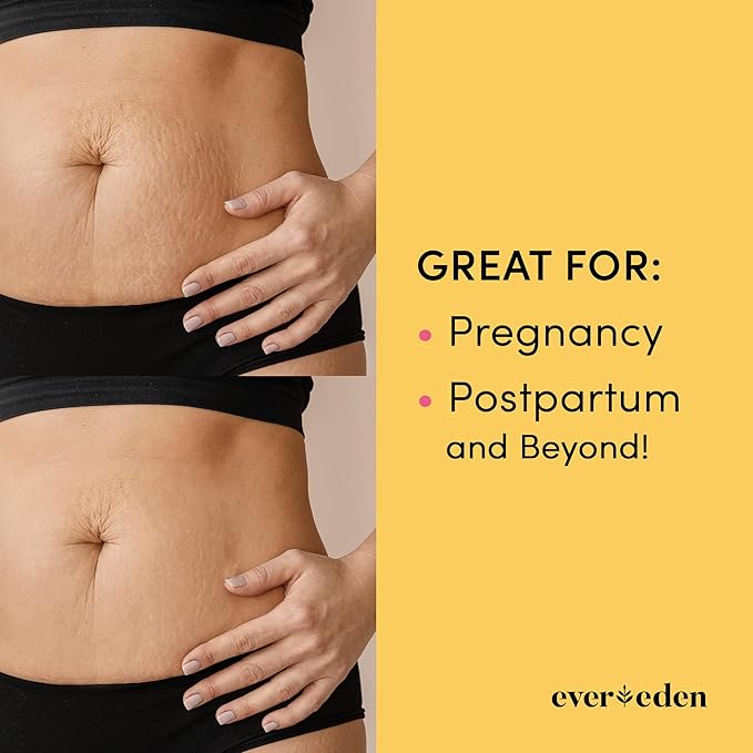 Evereden Nourishing Stretch Mark Cream 50ml | Clean and Unscented Pregnancy Skincare | Stretch Mark Prevention-VivaGrace Women