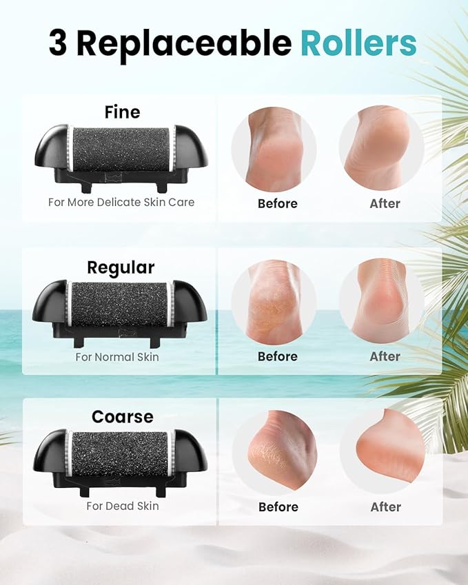 Electric Foot Callus Remover with 10000 RPM Motor and 3-Speed Settings, Foot File Kit with LED Light and Display for Women’s Home Pedicure, Waterproof Foot Grinder with Type-C Charging-VivaGrace Women