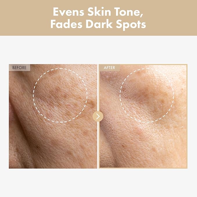 Rice Glow Milky Toner with 784,000ppm Korean Rice Water, Niacinamide, Ceramides, Panthenol, Glow, Glass Skin, Hydrating, Purifying, Fragrance-Free, Korean Skin Care, 250ml, 8.45 fl.oz.-VivaGrace Women