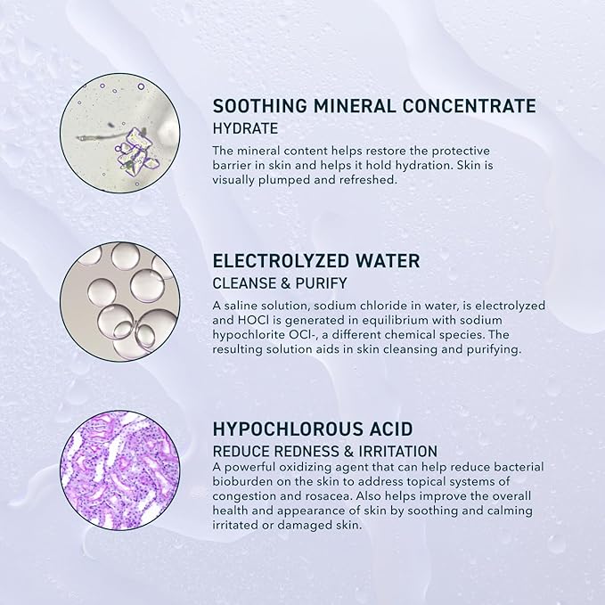 Skin Universal Skin Solution Hypochlorous Acid Spray for Face and Body. HOCL Facial Cleanser and Dermal Spray with Electrolyzed Water and Mineral Complex. pH-Stabilized Skin Care. 4oz-VivaGrace Women