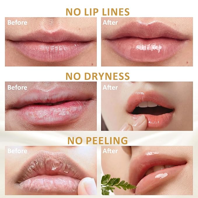 DMSKY 6 PCS Bee Lip Balm Honey Pot, Propolis Lip Mask Overnight, Moisturizing Hydrating Lip Sleeping Mask Prevention Dry and Cracked, Reduce Lip Lines-VivaGrace Women