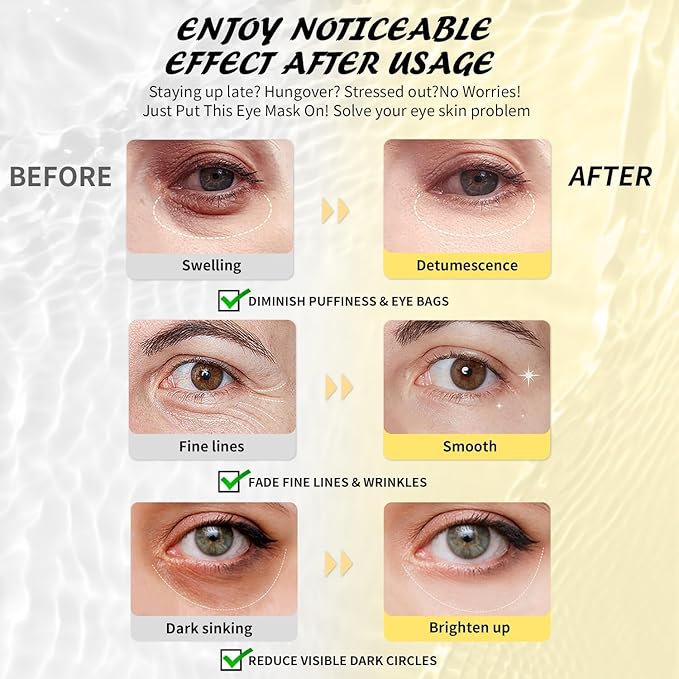 Under Eye Patches(30 Pairs), 24K Gold, Caffeine, Hyaluronic Acid, Aloe Vera Eye Masks for Dark Circles Puffy Eyes Undereye Bags, Eye Skin Care Gift Set for Bachelorette Party Favors-VivaGrace Women