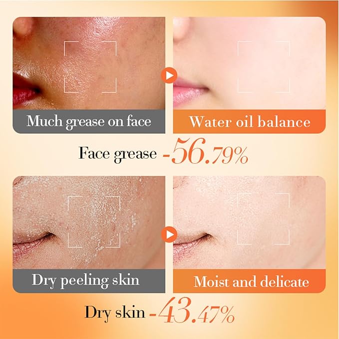 Vitamin B5 face routine set for women - women's skin care set - facial care set - Promote skin metabolism, moisturize, reduce oil, repair skin-VivaGrace Women