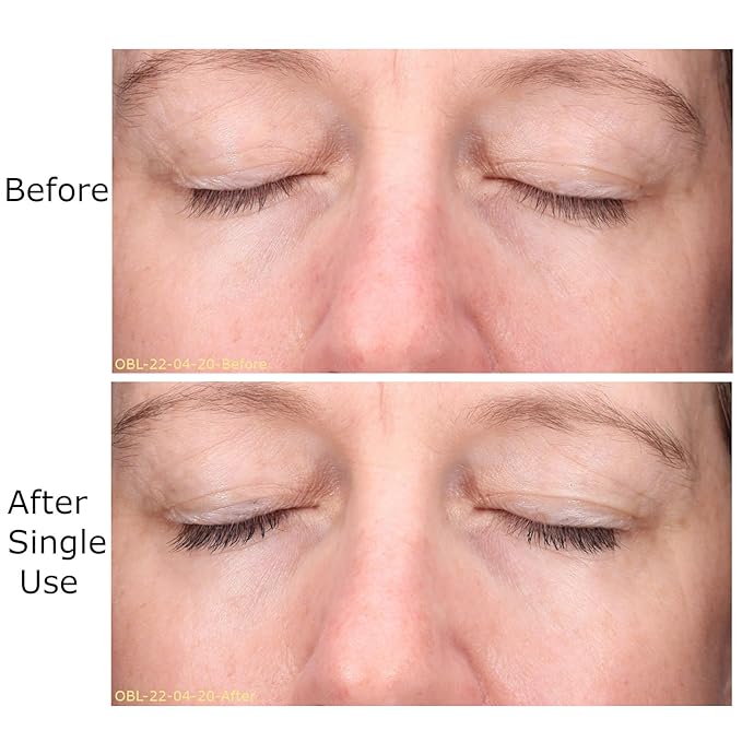 Hydrate & Soothe Beauty Collection, Activator with Awaken Facial & Vitamin B Concentrate, Face smoothing moisturizer, Skin Care Routine, For All Skin Type, Gift Bundle / Starter Kit-VivaGrace Women