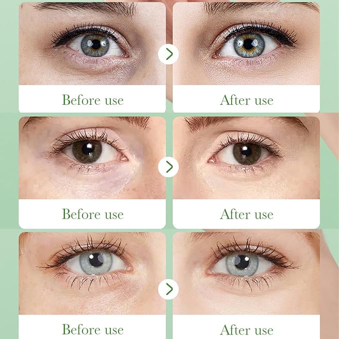 60 Pcs Under Eye Patches, Aloe Vera Eye Masks for Dark Circles & Puffiness with Collagen, Relieve Dryness, Reduce Fine Lines, Soothing Hydrating Under Eye Mask, Skin Care Eye Patches-VivaGrace Women