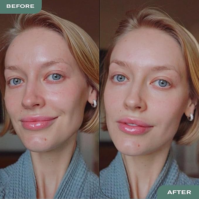 Erno Laszlo Shake-It Tinted Skin Treatment, Light Face Tint for Fair Complexions, Beautiful Skin Tone, Controls Oil, Natural Matte Finish (3 Fl Oz)-VivaGrace Women