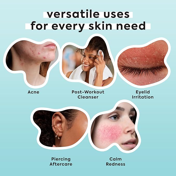 Hypochlorous Acid Spray for Face & Body - Helps Reduce Redness and Breakouts - Travel Size Hypochlorous Spray, Multi-Purpose Topical Facial Skin Repair, pH-Balancing Toner - TSA, Livaclean-VivaGrace Women