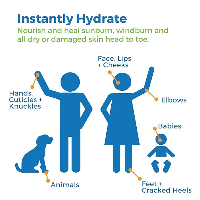 Waxhead Aftersun Body Butter for Sunburn Relief - Also great Tattoo Balm, Eczema Cream for Kids Adults, After Sun Lotion, Sunburn Treatment, Healing Salve-VivaGrace Women