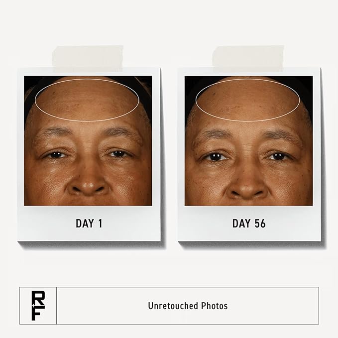 Rodan + Fields Redefine Regimen | Skincare Kit Includes Clay Cleanser, Toner, Triple Defense Cream, & Overnight Cream | Skin Care Gift Set for Women