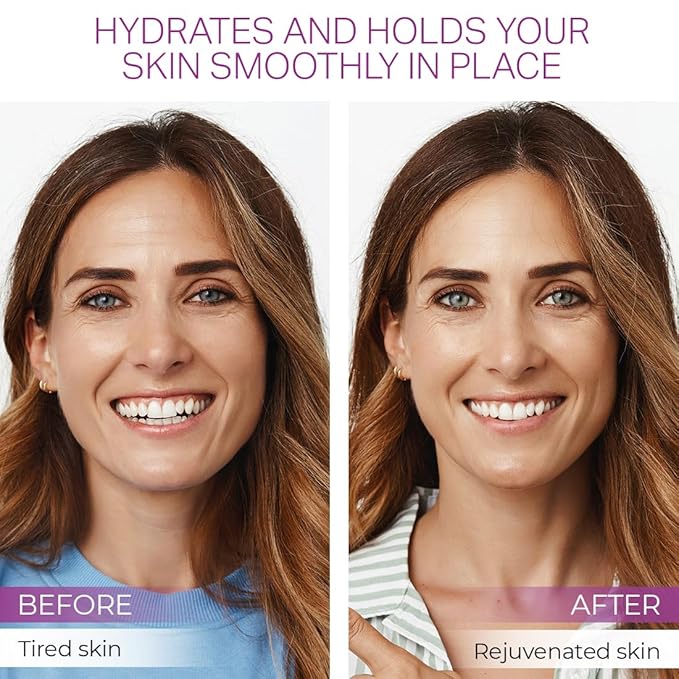 Furlesse Rows Wrinkle Patches, Overnight Forehead Wrinkle Patches for Fine Horizontal Lines, Non-Invasive Anti-Wrinkle Patches, Anti-Aging Skincare, 30 Patches, 30-Day Use-VivaGrace Women