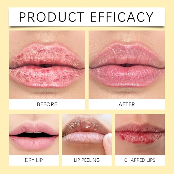 Lemon Lip Balm | All Natural Turmeric Lip Balms & Moisturizers | Hydrates Care Lip Balm, Brighten & Nourish Dark Lips Effortlessly-VivaGrace Women