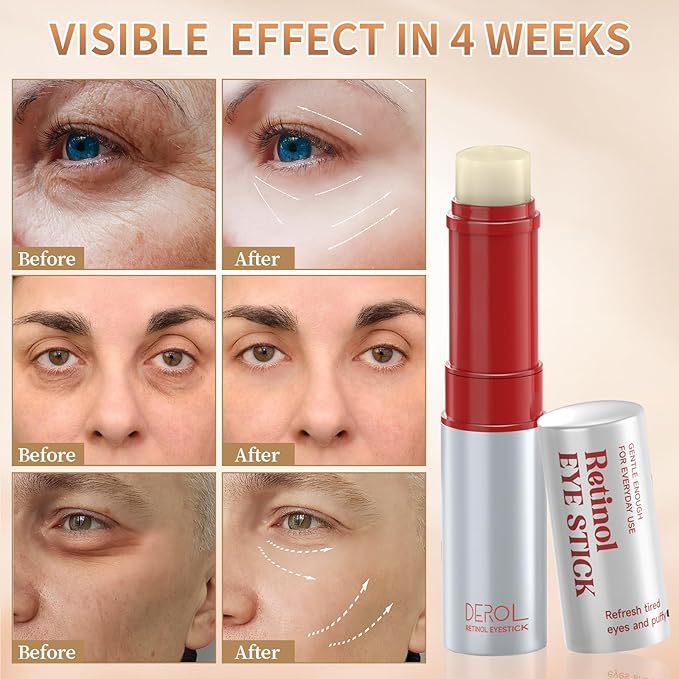 Retinol Eye Cream, Wrinkle Repair Eye Cream for Dark Circles, Under Eye Bag Cream with Retinol & Hyaluronic Acid, Eye Cream Anti Aging to Fight Fine Lines, Reduce Eye Bags,Wrinkles in 3-4 Weeks-VivaGrace Women