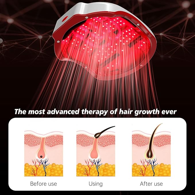 Hair Growth Device,LED Light Therapy Cap,Red Light Cap,Hair Regrowth Treatment for Men and Women-VivaGrace Women