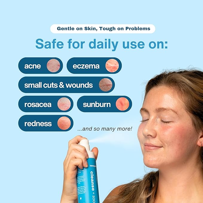 Hypochlorous Acid Spray – HOCl Face & Skin Mist for Acne, Eczema & Irritation – Multi-Purpose Skin Repair – Eyelid Cleanser, Post-Workout, Post-Procedure, Scalp & Sensitive Skin – 6.8 oz-VivaGrace Women