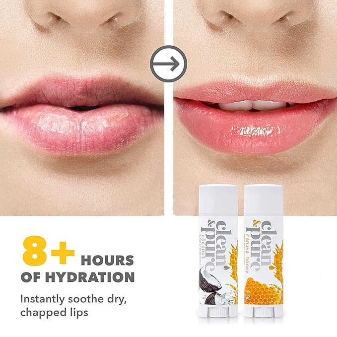 Lip Balm 2-Pack (Manuka Honey & Coconut) | Lip Care Set With 100% All Natural Beeswax | Vitamin E Oil…-VivaGrace Women