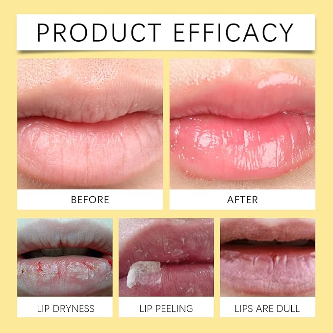 Honey Lip Balm, Propolis Long Lasting Hydrating Lip Butter & Mask, Overnight Nourishing Care, Gentle Exfoliation, Non-sticky Fresh Texture-VivaGrace Women