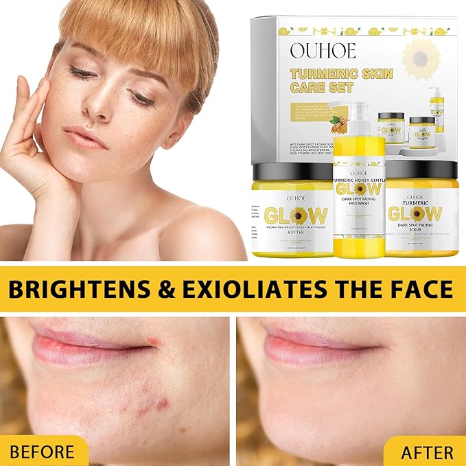 Glow Combo Skincare Set,3 In 1 Turmeric Combo Skincare Set，Turmeric Glow Butter, Skincare Gift Set For All Skin Type (1 Set)-VivaGrace Women
