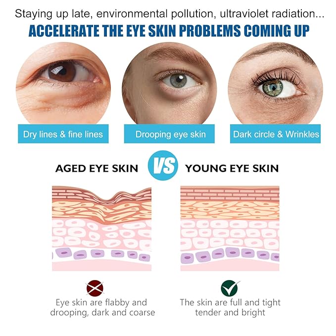 [ 28 Pairs ] Under Eye Patches, Eye Gel Mask for Puffy Eyes and Dark Circles with Natural Marine Collagen Reduce Wrinkles Anti-Aging Face Eye Skin Care Mask for Face,Puffiness, Eye Bags and Wrinkles-VivaGrace Women