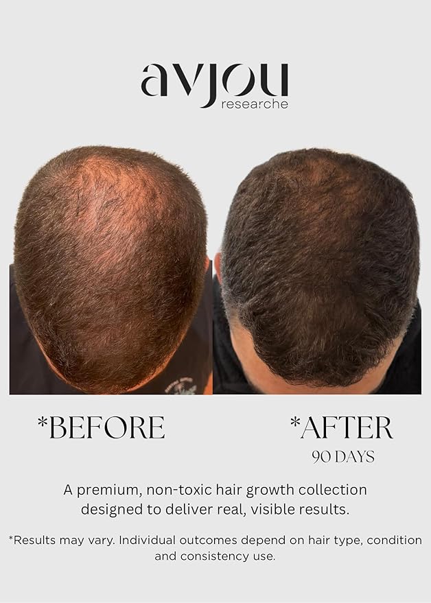 Avjou Researche™ Scalp Serum – Thicker, Fuller-Looking Hair + Targets Visible Signs of Premature Greying – 3 Patented Ingredients – Backed by Cosmetic Science – Oil-Free, All Hair Types, 1.7 oz-VivaGrace Women