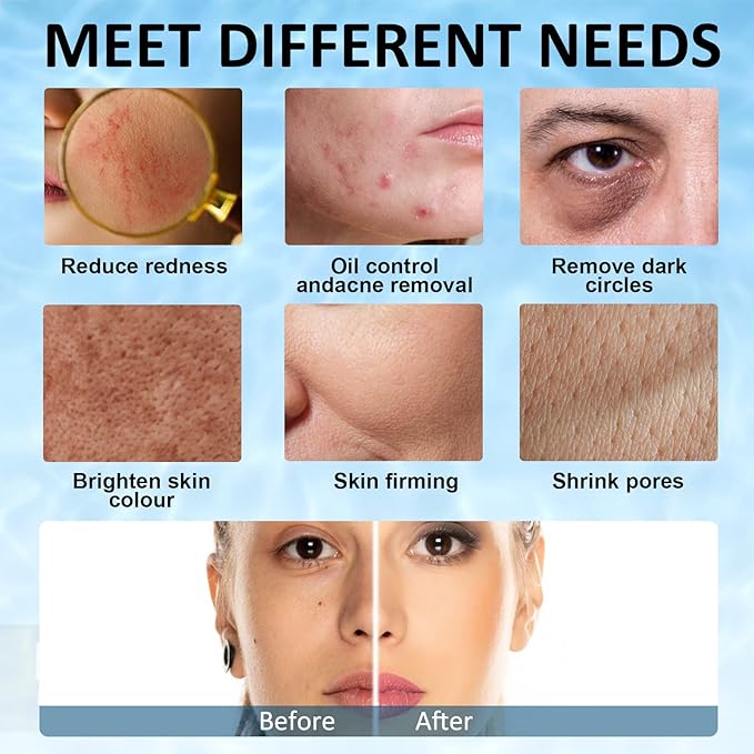 Ice Face Roller, Joyeee Silicone Ice Roller For Face and Eyes Puffiness Relief Reusable Face Ice Cubes Migraine Pain Relief Facial Ice Mold Skincare Tools Gifts for Women Beauty-VivaGrace Women