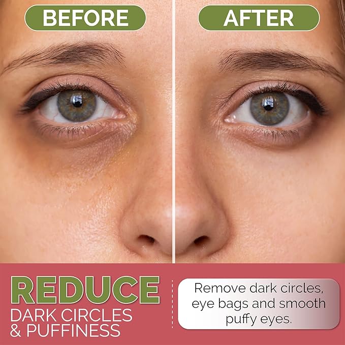 Under Eye Mask for Dark Circles, Puffiness and Eye Bags with Rose (60 Patches), Anti-Wrinkle for Puffy Eyes, Eye Masks with Hyaluronic Acid and Collagen Hydrogel Eye Gel Pads, Premium Korean Skincare-VivaGrace Women