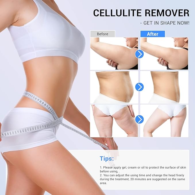 sens for Improvement in The Appearance of Cellulite Device Cellulite Massager Radio Frequency, White-VivaGrace Women
