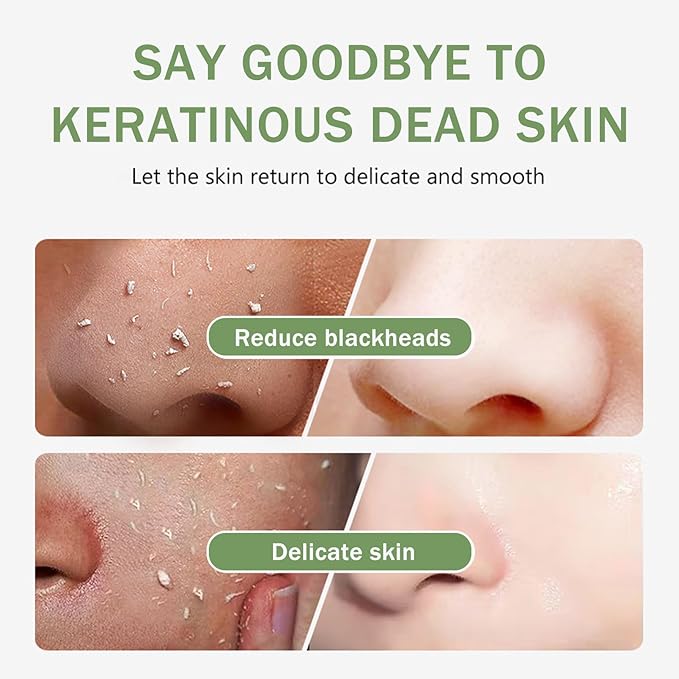 KOEC Purifying Exfoliating Gel with Face Washing Brush, Exfoliating Face Wash, Deep Cleansing Peeling Gel for the Whole Body, Facial Scrub Exfoliator, Oil & Dirt Cleanser for All Skin Types (2PCS)