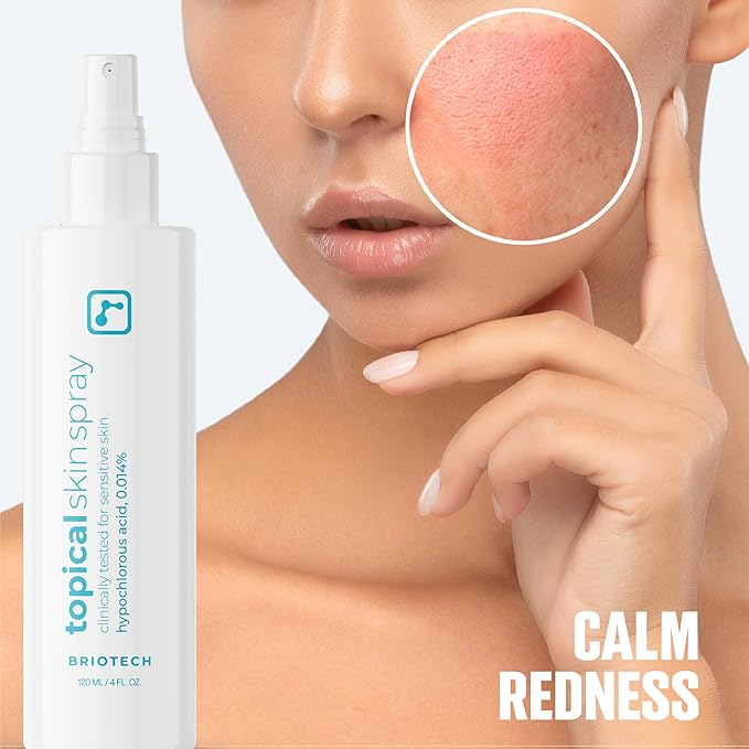 BRIOTECH Topical Skin Spray, Hypochlorous Acid Spray for Sensitive Skin, HOCl Facial Mist, Full Body Support Against Irritation, Calm Redness, Soothe Foot & Scalp, 8 oz (1 Pack)-VivaGrace Women