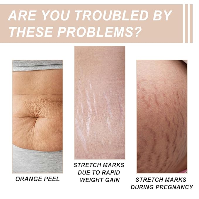 Butter Drench Restorative Rich Face Cream, Reduces Pregnancy Repair Skin, Hydrating Face Lotion, Helps Skin Retain Moisture, Soothes Dry Skin-VivaGrace Women