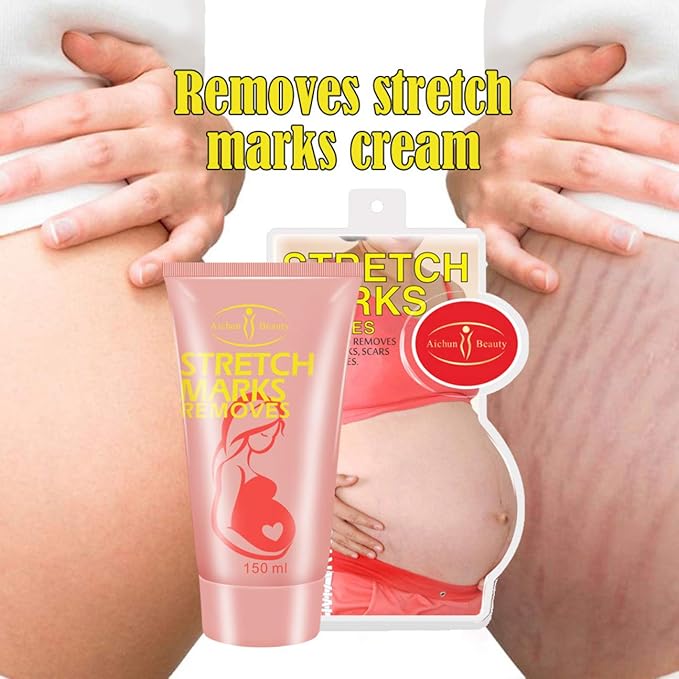 AICHUN BEAUTY Pregnancy Cream Streach Mark Remover Scars Repair Cellulites Lotion Cream 150ml-VivaGrace Women