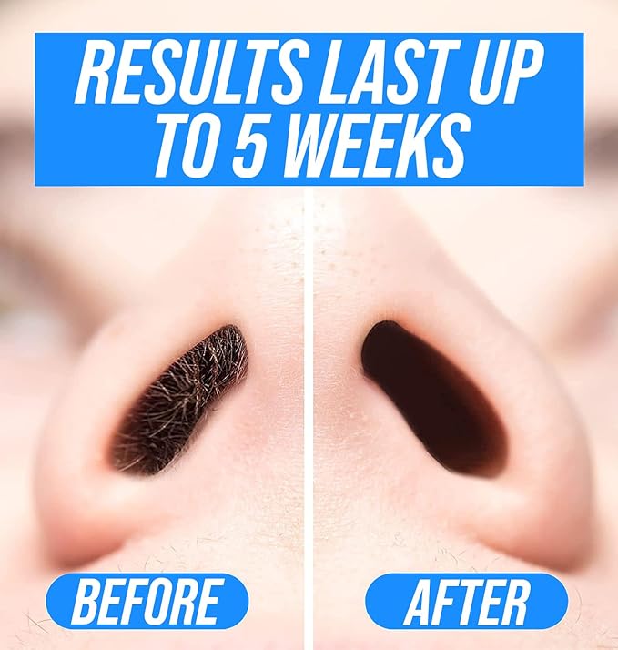 KENASHII Nose Wax Kit | 100 g Wax, 24 Applicators | Hair Removal Kit for Men and Women | Includes Balm Wipes and Mustache Guards | Lasts up to 5 Weeks-VivaGrace Women