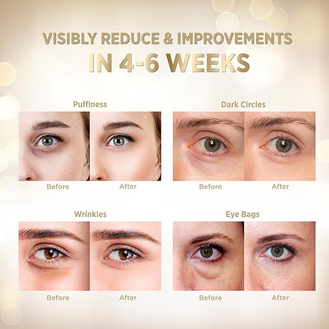 VELAMO ADVANCED Under Eye Patches: 24K Gold Under Eye Mask for Puffy - Retinol Patchology Eye Patches for Wrinkles and Dark Circles Puffiness- Collagen Under Eye Bags Treatment for Women Men 60 Pcs-VivaGrace Women