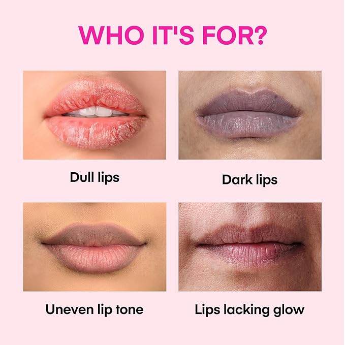 Lip Lightening for Dark Lips: for Smokers, Dry or Uneven-Toned Lips – Restores Natural Look & Moisture with VC, Lemon Peel & Licorice – Refreshing Mint Scent – 15 mL-VivaGrace Women