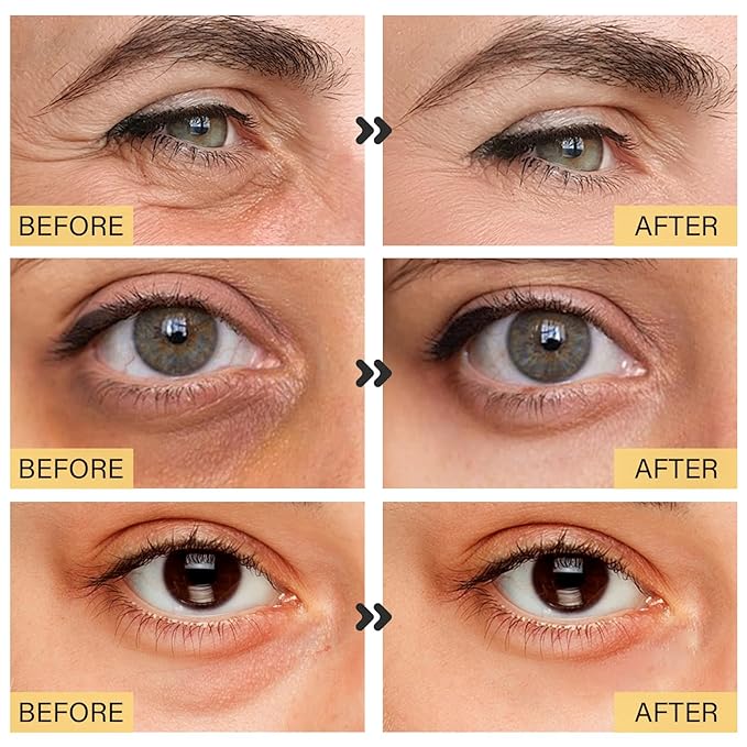 25 Paris Under Eye Patches Eye Mask for Puffy Eyes, Reducing Dark Circles, Anti-Aging & Refreshing, Collagen Eye Mask Eye Pads for Skin Care, 24K Gold-VivaGrace Women